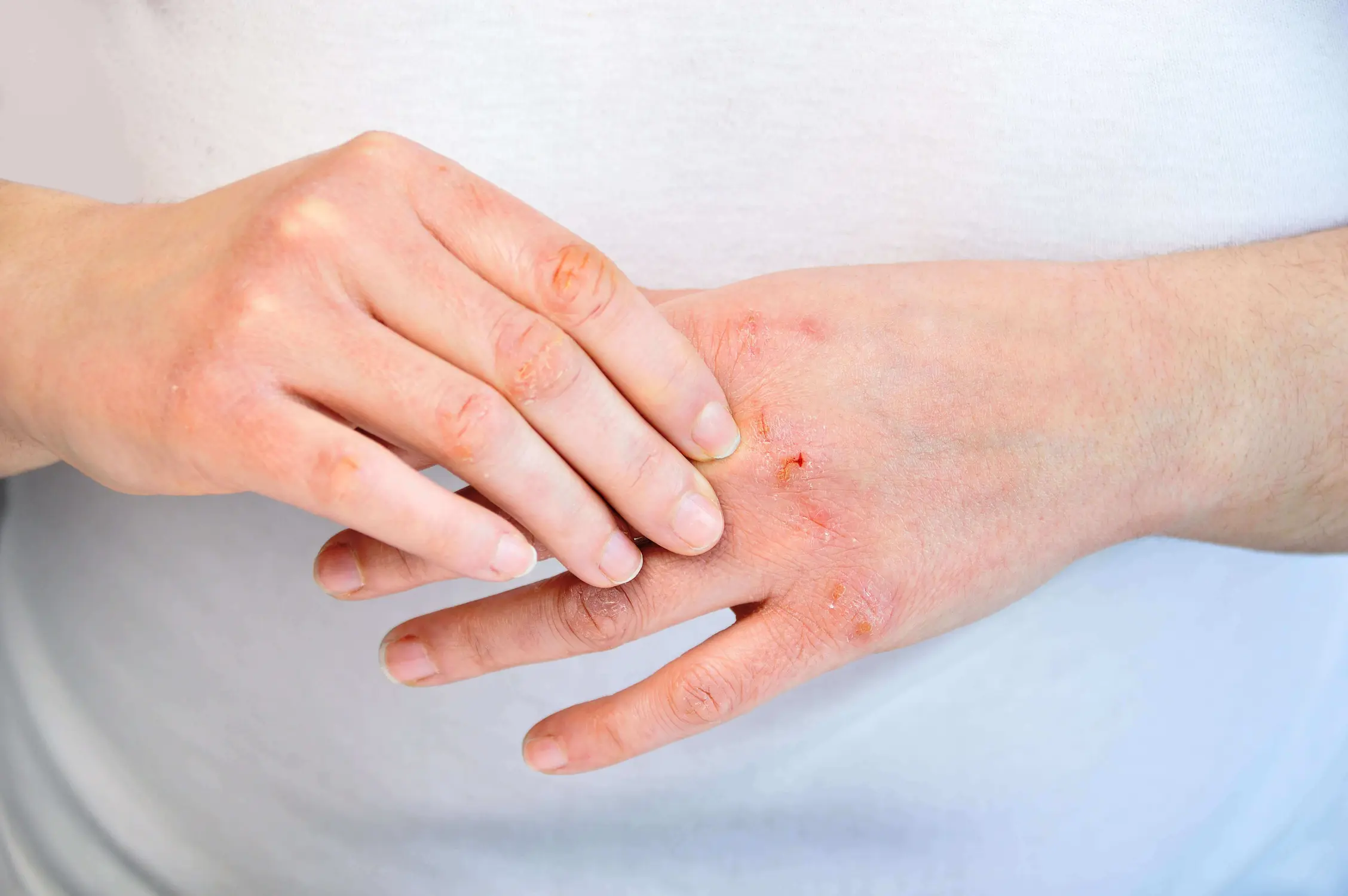 Is Your Hand Soap Actually Making Your Hands "Dirtier"?