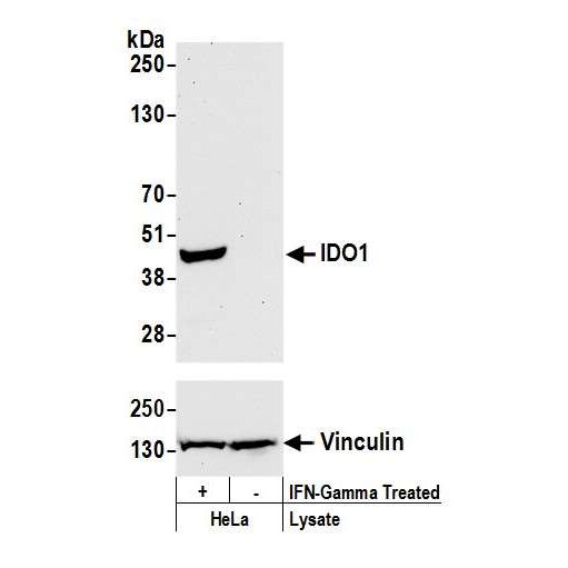 Western blot showing IDO1 expression in IFN-gamma treated HeLa lysates with vinculin as loading control.