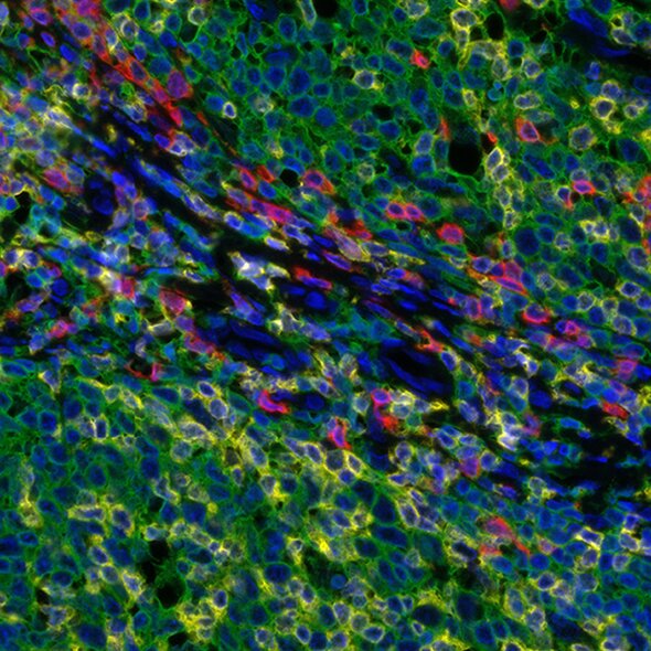 Fluorescence microscopy image showing multicolor staining of tissue with green, red, blue, and yellow markers