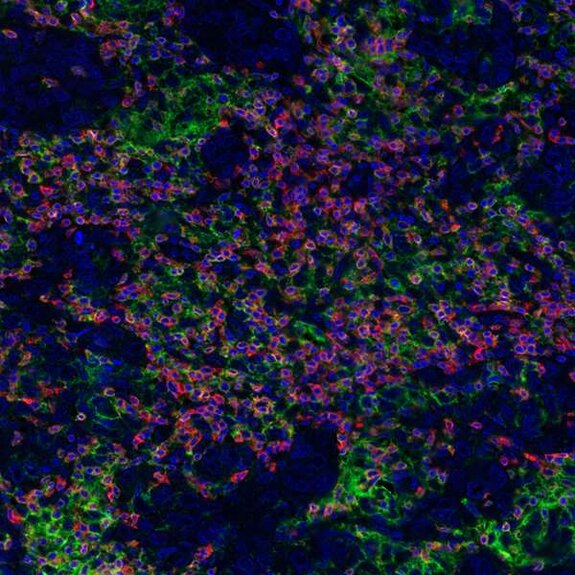 Fluorescence microscopy image showing tissue with red, green, and blue staining highlighting cell structures
