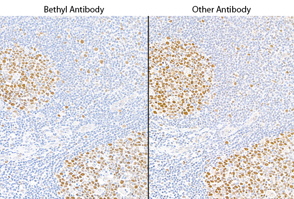 IHC staining of MSH6 protein using Bethyl antibody and competitor antibody showing similar patterns