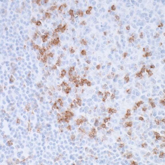 IHC staining showing brown-positive immune cells scattered among blue-stained nuclei in tissue section