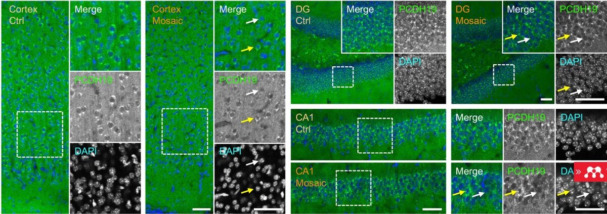 Immunofluorescence staining with anti-PCDH19 antibody shows that some cells are PCDH19-negative while others are PCDH19-positive.