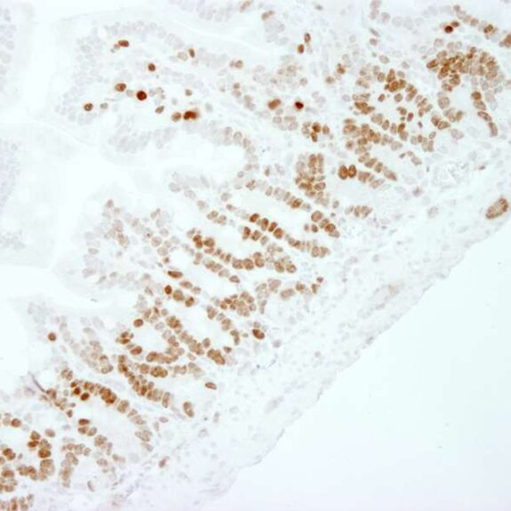 IHC image showing brown nuclear staining in epithelial cells lining intestinal villi with clear tissue morphology