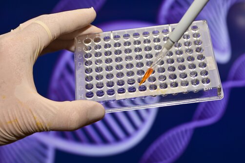 A laboratory technician's hand holding a microplate filled with samples, highlighting enzymes and master mixes used in advanced molecular biology techniques.