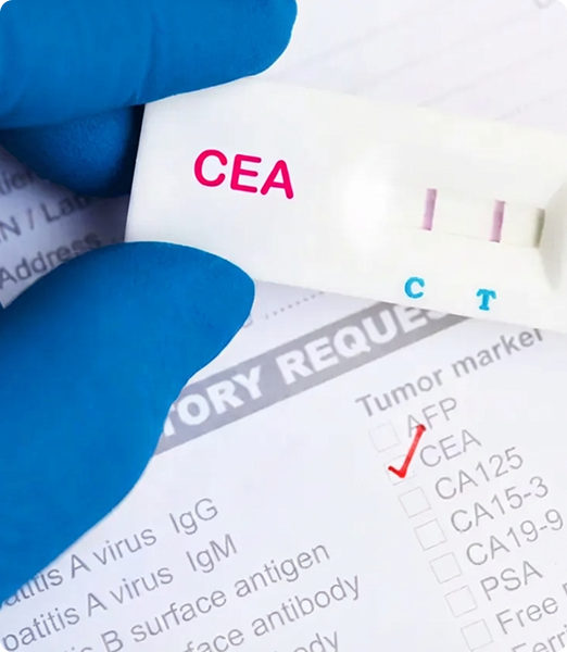 Gloved hand holding a CEA rapid lateral flow test cassette over a laboratory form