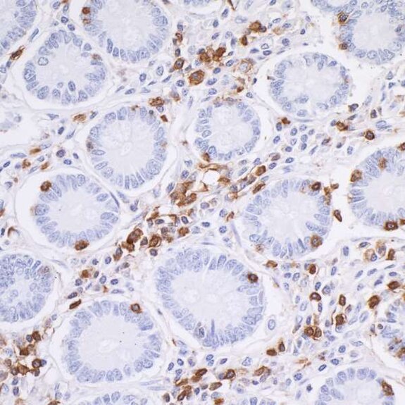 Immunohistochemistry image showing brown-stained immune cells around blue-stained glandular structures - Detection of CD45 in a FFPE section of human small intestine by IHC.