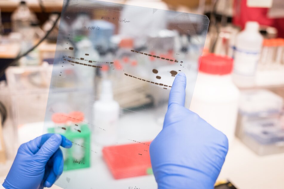 Protein detection by Western blot highlighting validated antibody performance for reliable assays