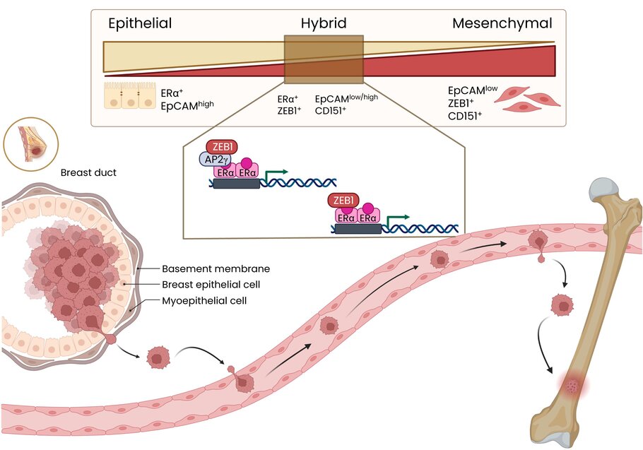 Epithelial cells in the breast are ER-alpha positive and EpCAM high, while mesenchymal cells are EpCAM low, ZEB1 positive and CD151 positive. Hybrid cells are susceptible to becoming metastatic due to the interaction between ER-alpha and ZEB1.