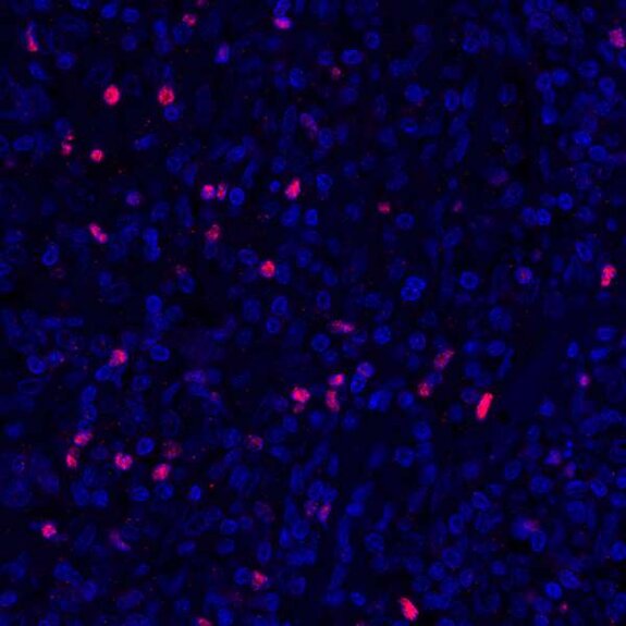 Fluorescence microscopy image showing blue-stained cells with scattered red-stained markers