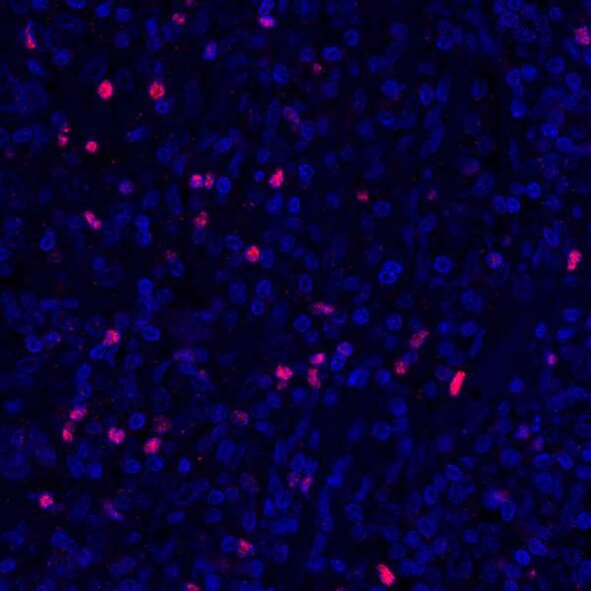 Fluorescence microscopy image showing blue-stained cells with scattered red-stained markers