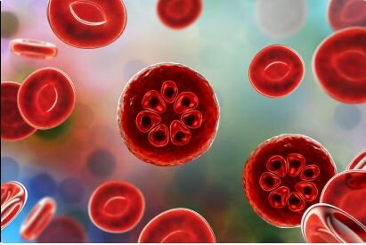 Red blood cells with malaria Plasmodium parasites inside