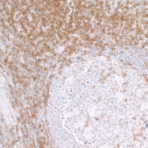 Immunohistochemistry (IHC) stained tissue section showing strong brown staining in the upper region and weak staining in the lower circular area.
