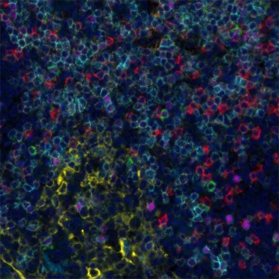 Fluorescence microscopy image showing multicolored stained cells with blue, red, green, and yellow markers in tissue