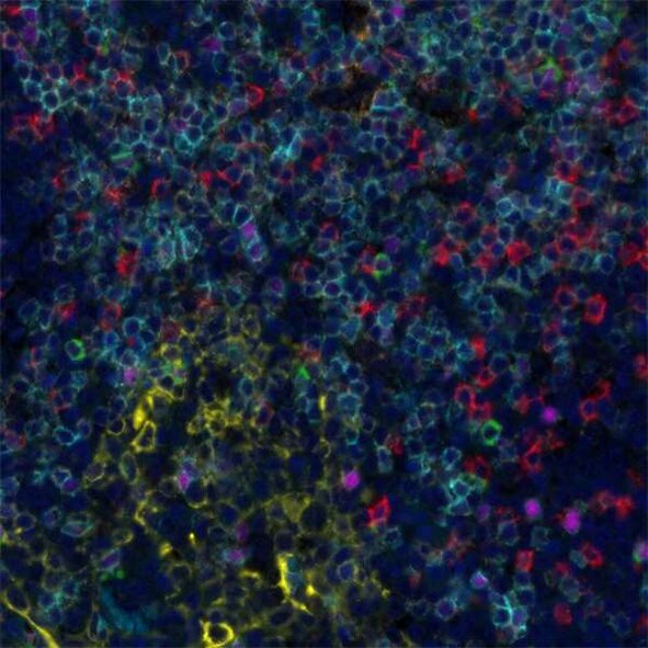 Fluorescence microscopy image showing multicolored stained cells with blue, red, green, and yellow markers in tissue