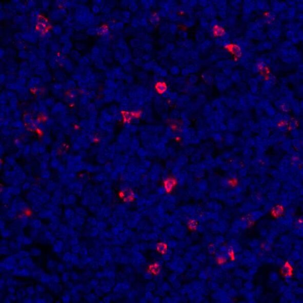 Fluorescence microscopy image of cells with blue nuclear staining and scattered red fluorescent markers