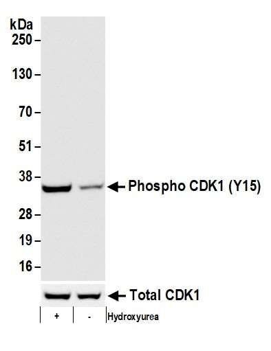 Western blot showing Phospho CDK1 Y15 and Total CDK1 expression with hydroxyurea treatment."