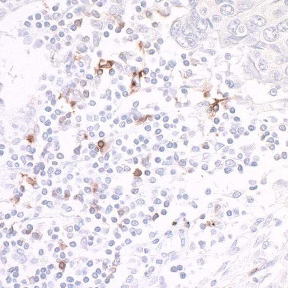 Immunohistochemistry image showing scattered brown staining of specific cells among mostly unstained nuclei in tissue section