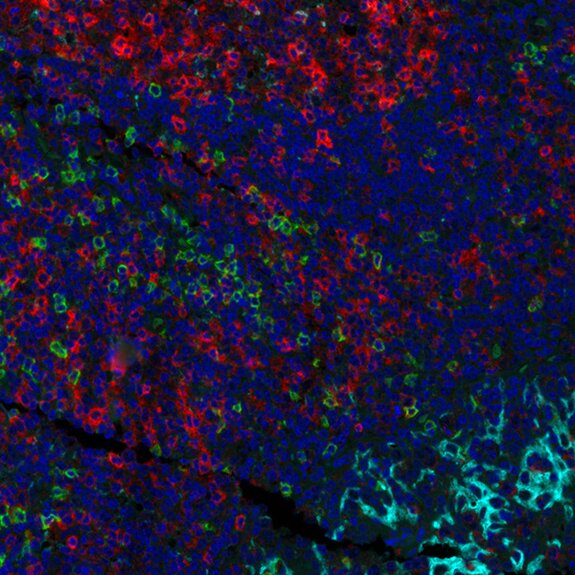 Fluorescent microscopy image of tissue showing red, green, and cyan markers with blue-stained nuclei for cellular visualization.