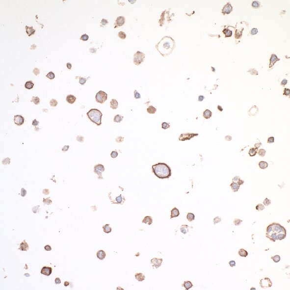 Immunohistochemistry image showing scattered brown-stained cells with clear nuclei on a light background.