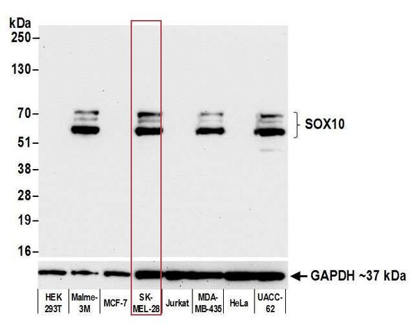 Western blot analysis of SOX10 expression in cancer cell lines normalized to GAPDH