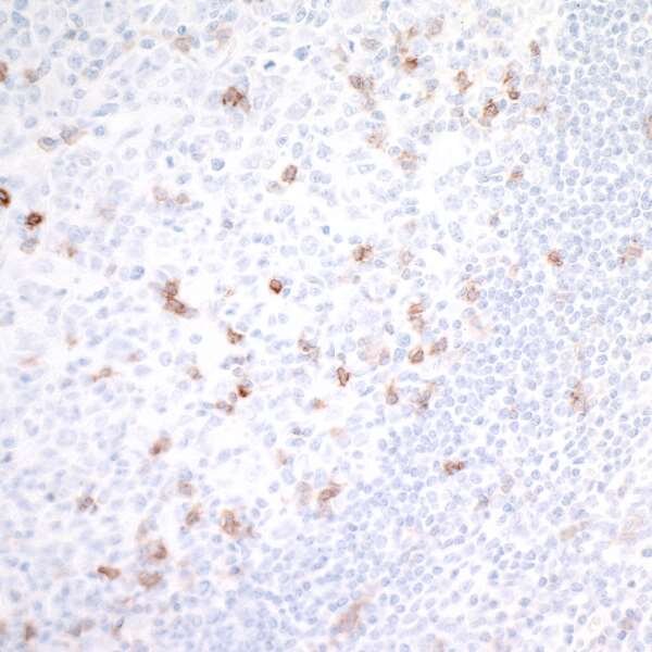Immunohistochemistry image showing scattered brown-stained FOXP3-positive cells within tissue against a light background.