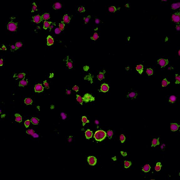 Fluorescent microscopy image showing magenta-stained cells with green outlines against a black background