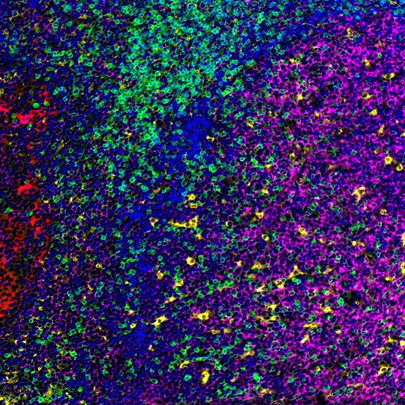 Multiplex immunofluorescence image showing immune cell diversity with green, magenta, red, yellow, and blue markers.