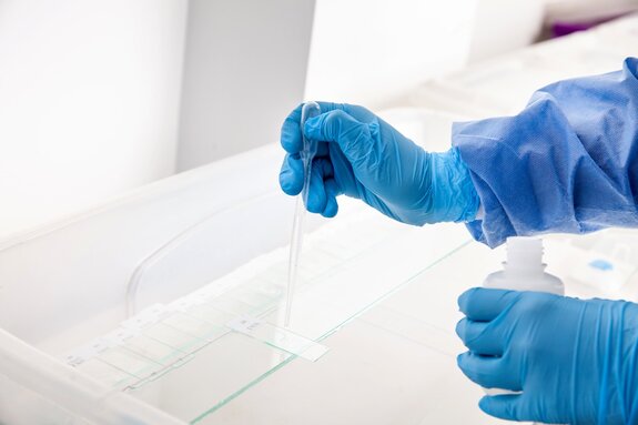 Person wearing blue gloves and applying a droplet of buffer to a clear glass slide.