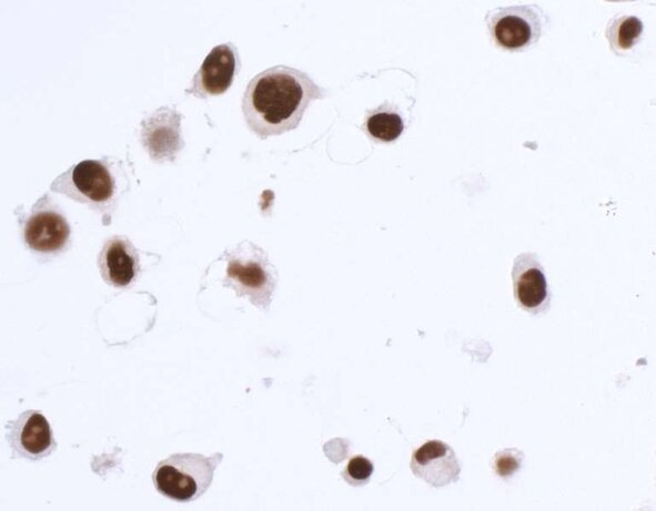 Immunocytochemistry image showing protein expression in stained human cells