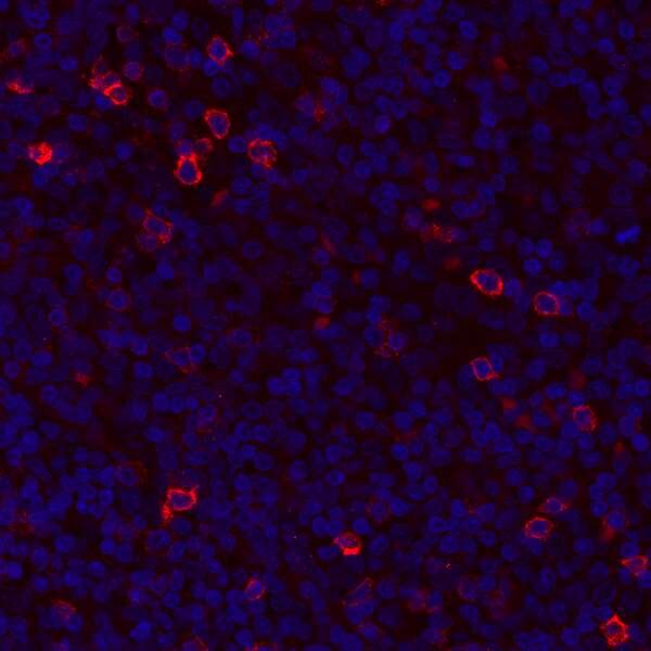 Fluorescence microscopy image showing red-stained FOXP3-positive cells against a blue nuclear counterstain background.