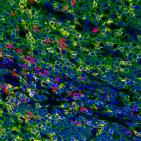 Fluorescent microscopy image showing stained tissue with green cell outlines, blue nuclei, and scattered red signal markers.