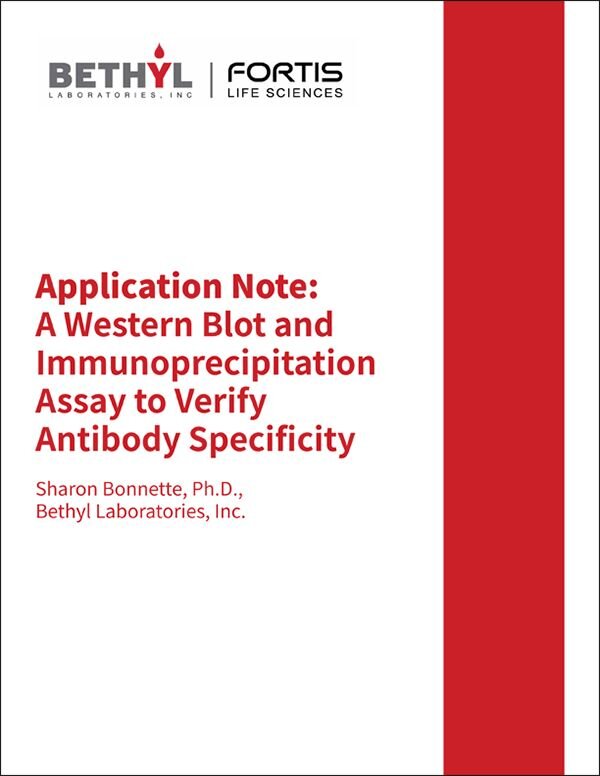 Bethyl Laboratories application note on Western Blot and Immunoprecipitation assays to verify antibody specificity