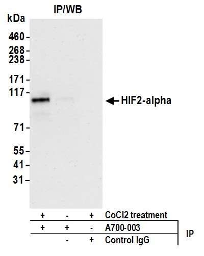 Western blot showing HIF2-alpha protein detection after CoCl2 treatment using specific antibody and IgG control.