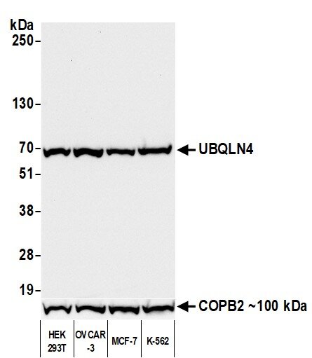 Western blot showing a band around 70 kDa, representing UBQLN4 and a band showing COPB2.