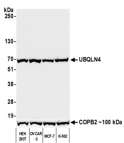 Western blot of UBQLN4 (~70 kDa) and COPB2 (~100 kDa) in HEK293T, OVCAR-3, MCF-7, and K-562 cell lines.
