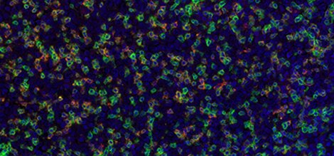 Fluorescent microscopy image showing cells stained with green and red markers against a dark blue background