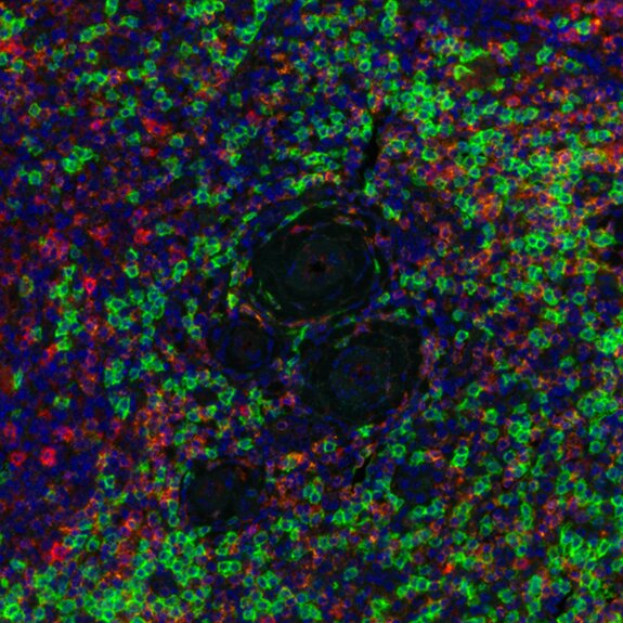 Fluorescent microscopy image of tissue showing green, red, and blue markers highlighting cellular structures and nuclei.