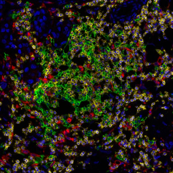 Fluorescence microscopy of tissue showing blue nuclei, green-stained cell membranes, and red markers for protein localization.