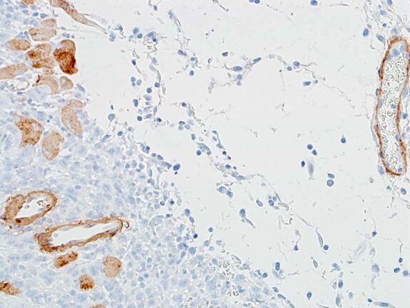 Immunohistochemistry image showing brown-stained positive cells and structures among mostly unstained or lightly stained tissue.