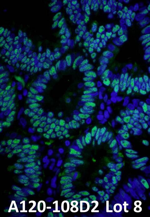 Fluorescence microscopy of blue nuclei and green stained columnar gland-like cells on black background labeled A120-108D2 Lot 8