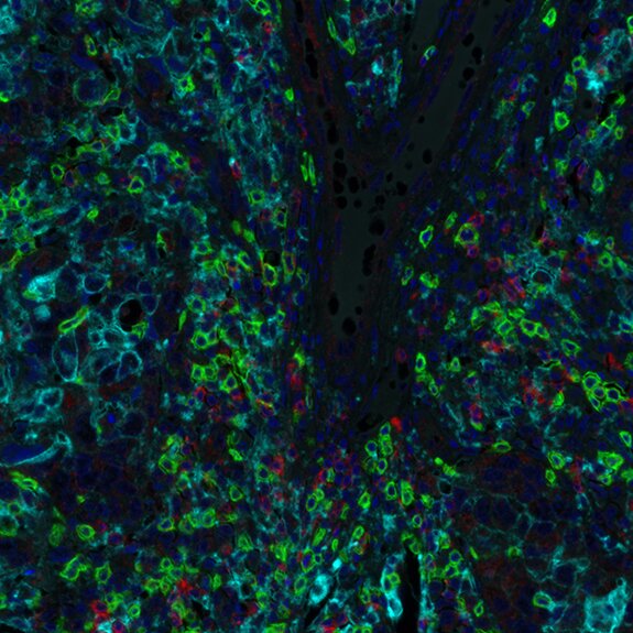 Multiplex immunofluorescence image of tissue with green, red, and blue markers highlighting cellular and structural organization.