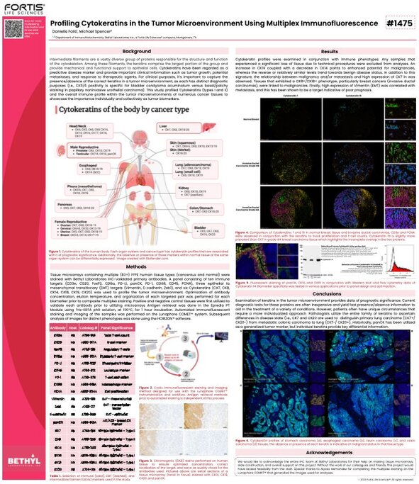 Scientific poster showing cytokeratin profiling in tumor microenvironments with fluorescent tissue images and anatomical diagrams
