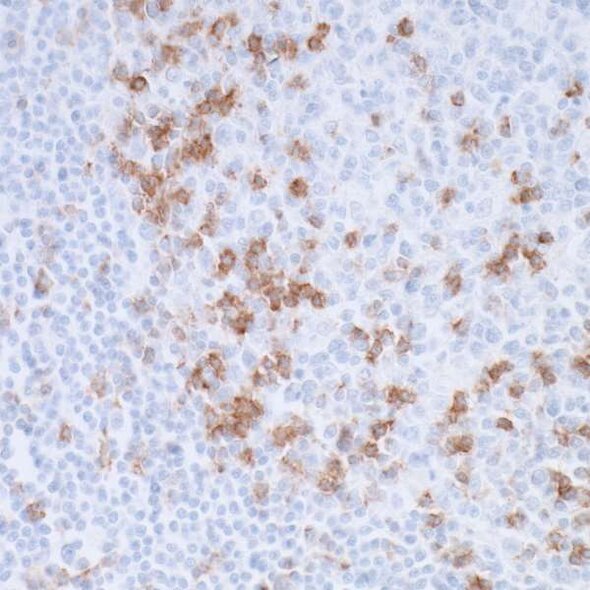 Immunohistochemistry image showing brown-stained positive cells among blue-stained background tissue