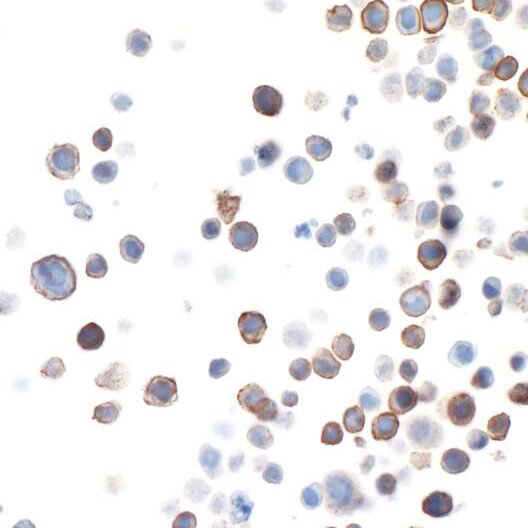 Detection of human TIM3 in FFPE RPMI-8226 cells by ICC