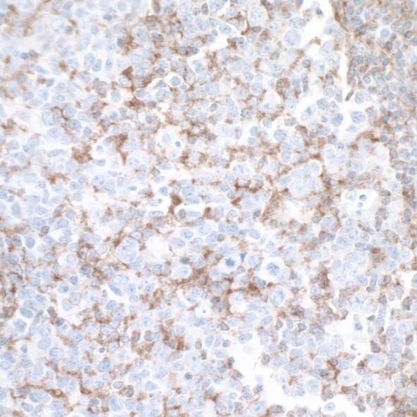 Detection of Human TIM3 in FFPE tonsil by IHC