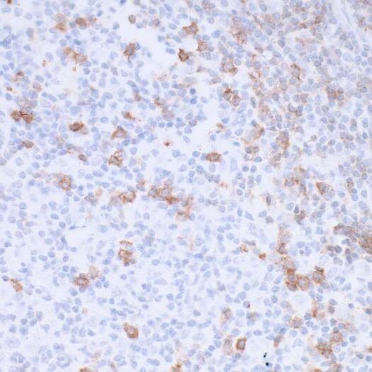 Immunohistochemistry (IHC) stained tissue section showing scattered brown-stained cells among blue counterstained nuclei.