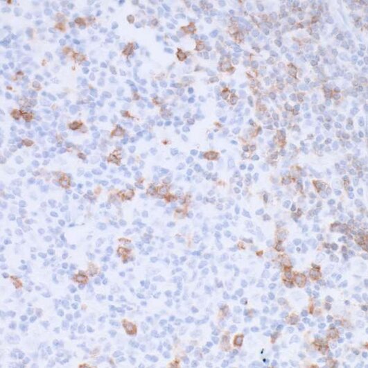 Immunohistochemistry (IHC) stained tissue section showing scattered brown-stained cells among blue counterstained nuclei.
