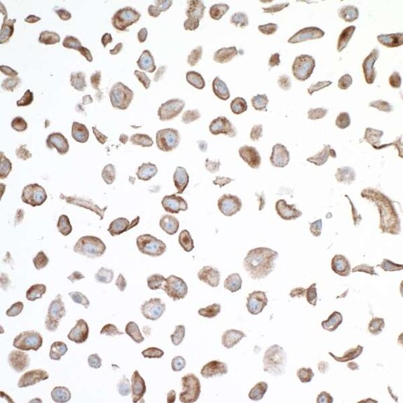 Immunohistochemistry image showing brown-stained cells with nuclear and cytoplasmic marker expression