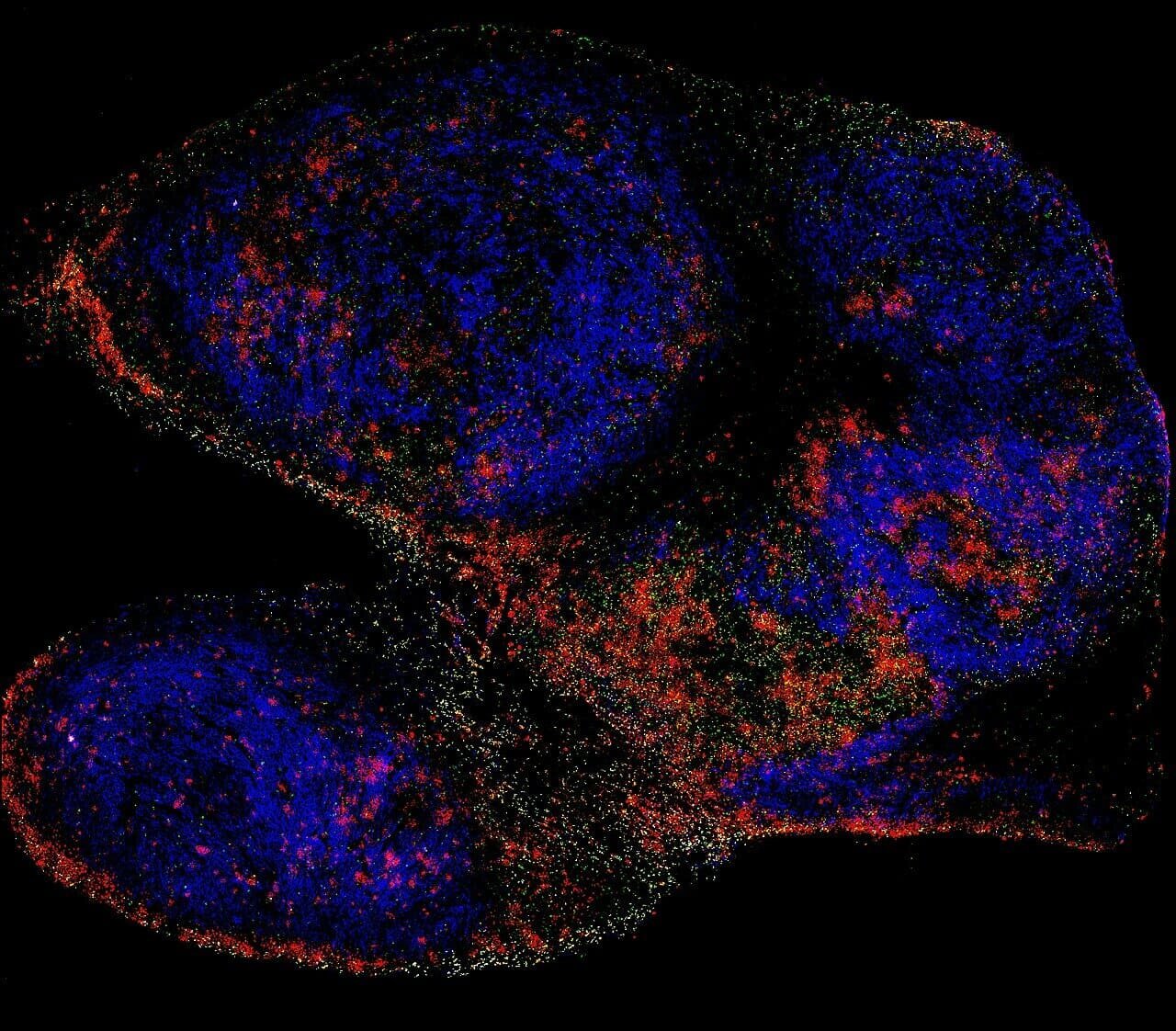 Fluorescence microscopy image of lymph node tissue with blue, red and green cell markers on black background
